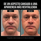 FORZA — Crema Facial Antiarrugas, Reafirmante y Antiojeras con Sebo de Res